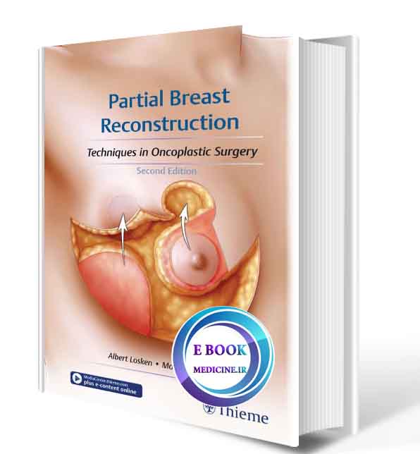 دانلود کتاب Partial Breast Reconstruction_ Techniques in Oncoplastic Surgery 2017 (Original PDF)  